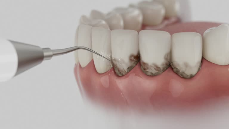 Reliable Dental contractor in Kellogg, ID by Smile Center Dentistry